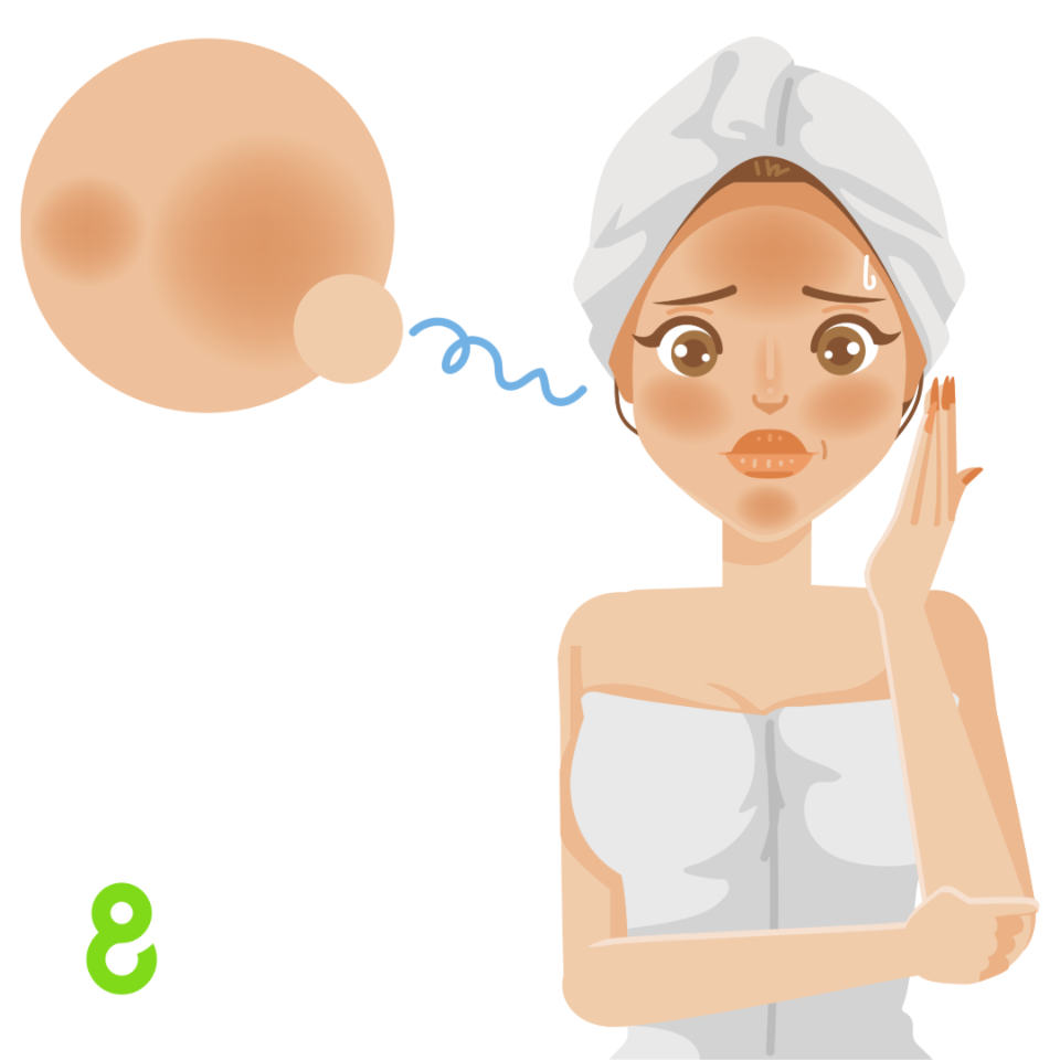 Hyperpigmentation & Dark Spots Solutions | 8thereal