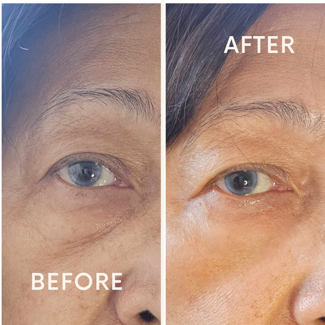Best Eye Cream + Youthful Appearance | 8thereal | Ageless Active Eye Cream by 8thereal featuring mature woman before and after.