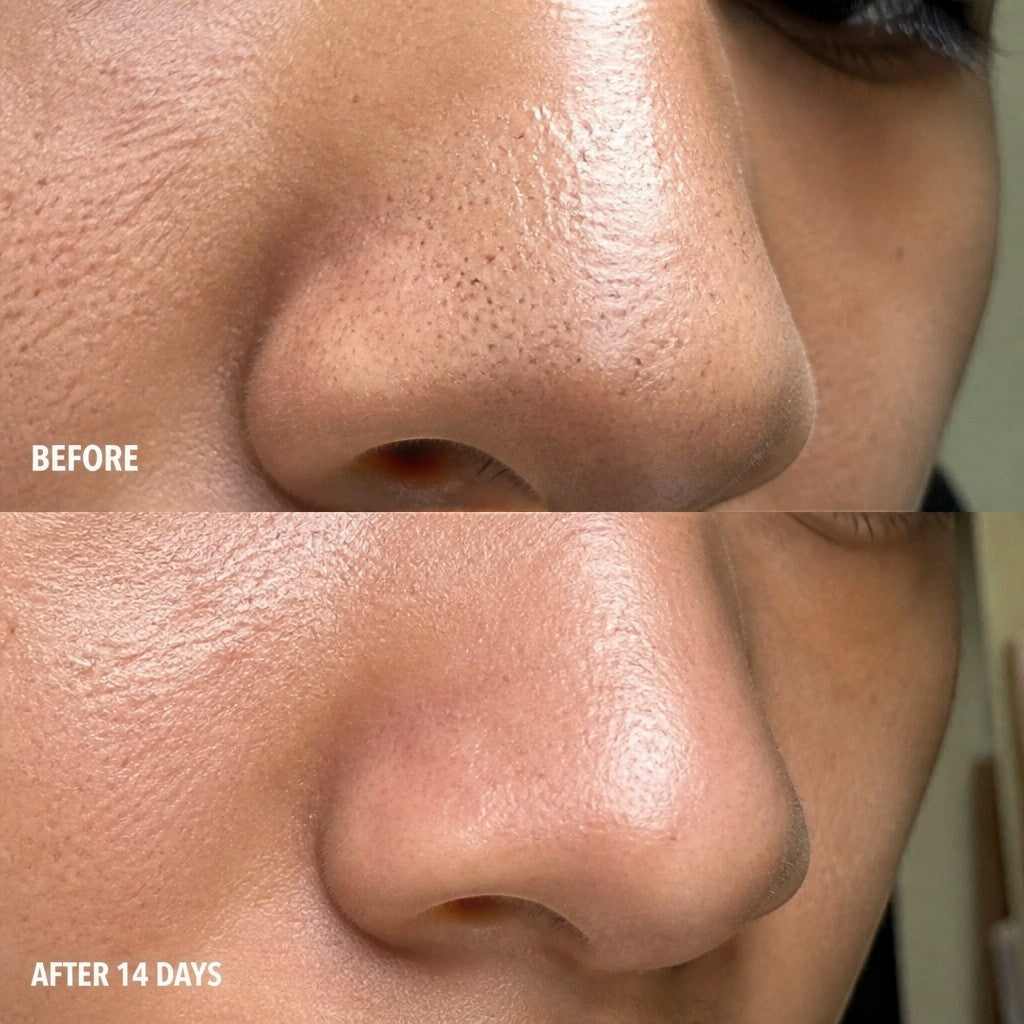 8thereal Deep-Cleansing Glow Mask before and after 14 days showing reduced pore congestion and clearer skin texture.