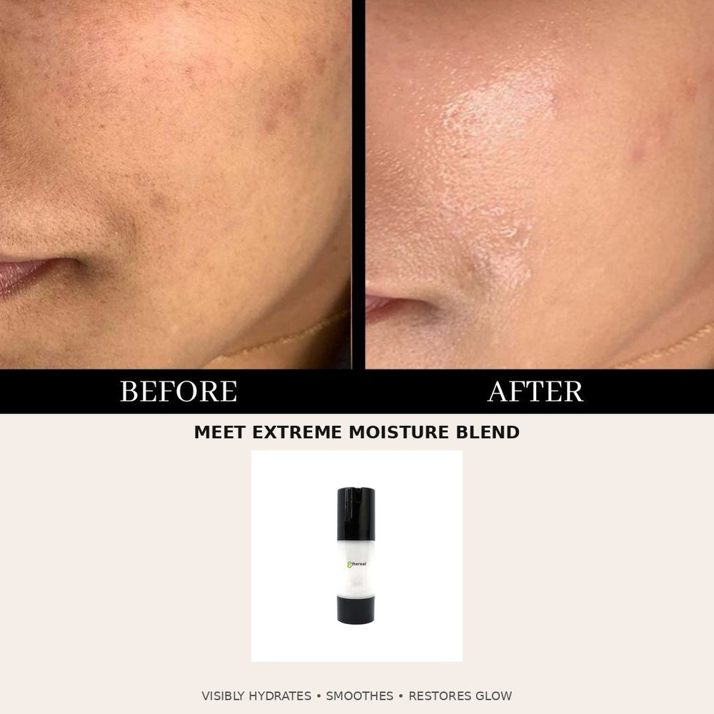 8thereal Extreme Moisture Blend showing before and after skin hydration results with the product bottle below.