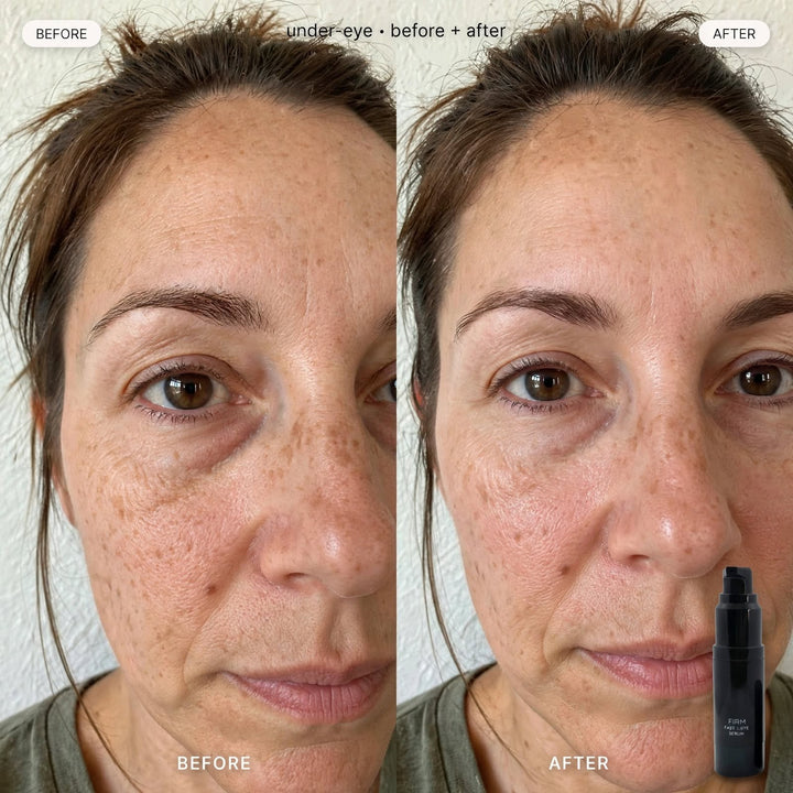 8thereal Firming Face & Eye Comfort Serum before and after results showing reduced under-eye puffiness and smoother skin