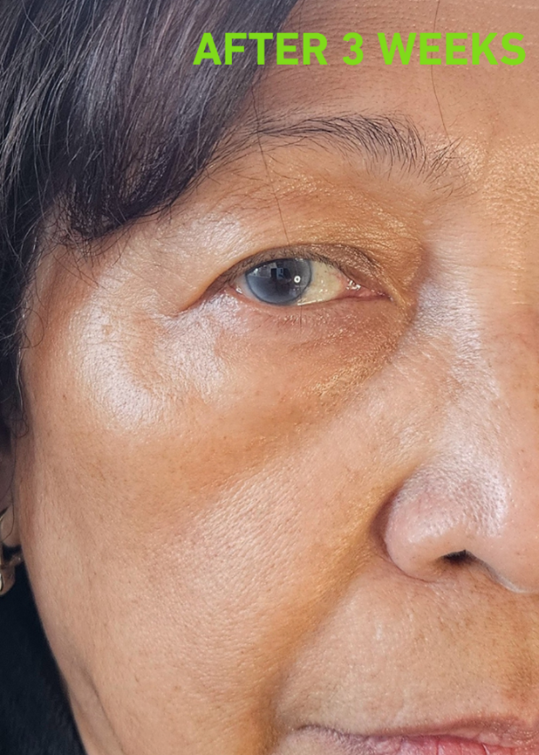 Age Defying Skincare 3 Week Results | 8thereal