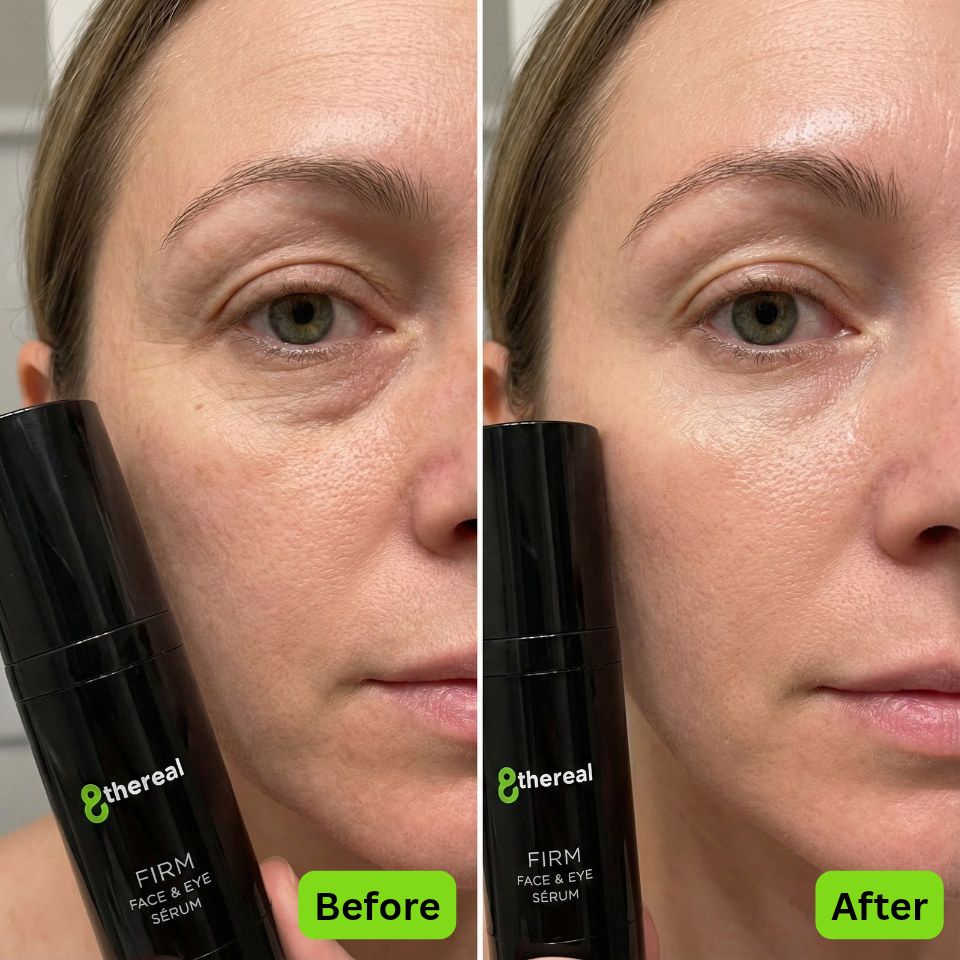 Before and after comparison of a woman's face with a serum bottle labeled '8thereal Firm Face & Eye Serum'.