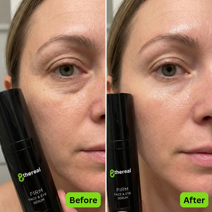 Before and after comparison of a woman's face with a serum bottle labeled '8thereal Firm Face & Eye Serum'.