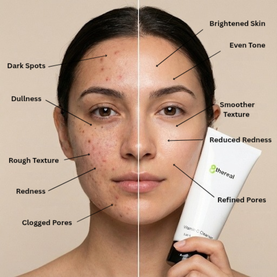 Before and after comparison of a woman's face with skin issues, showing the effects of a skincare product.