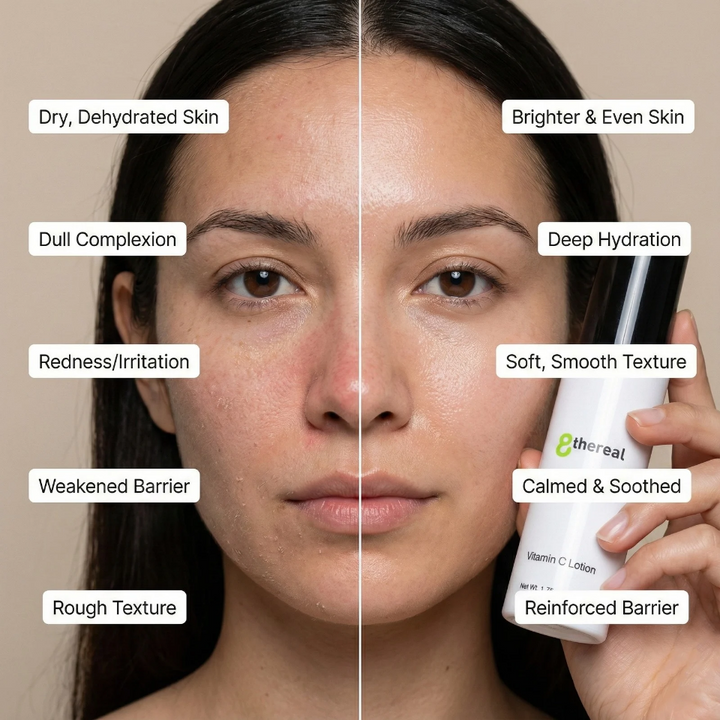 Before and after comparison of a woman's face with text labels on skin conditions and a bottle of '8thereal' Vitamin C Lotion.